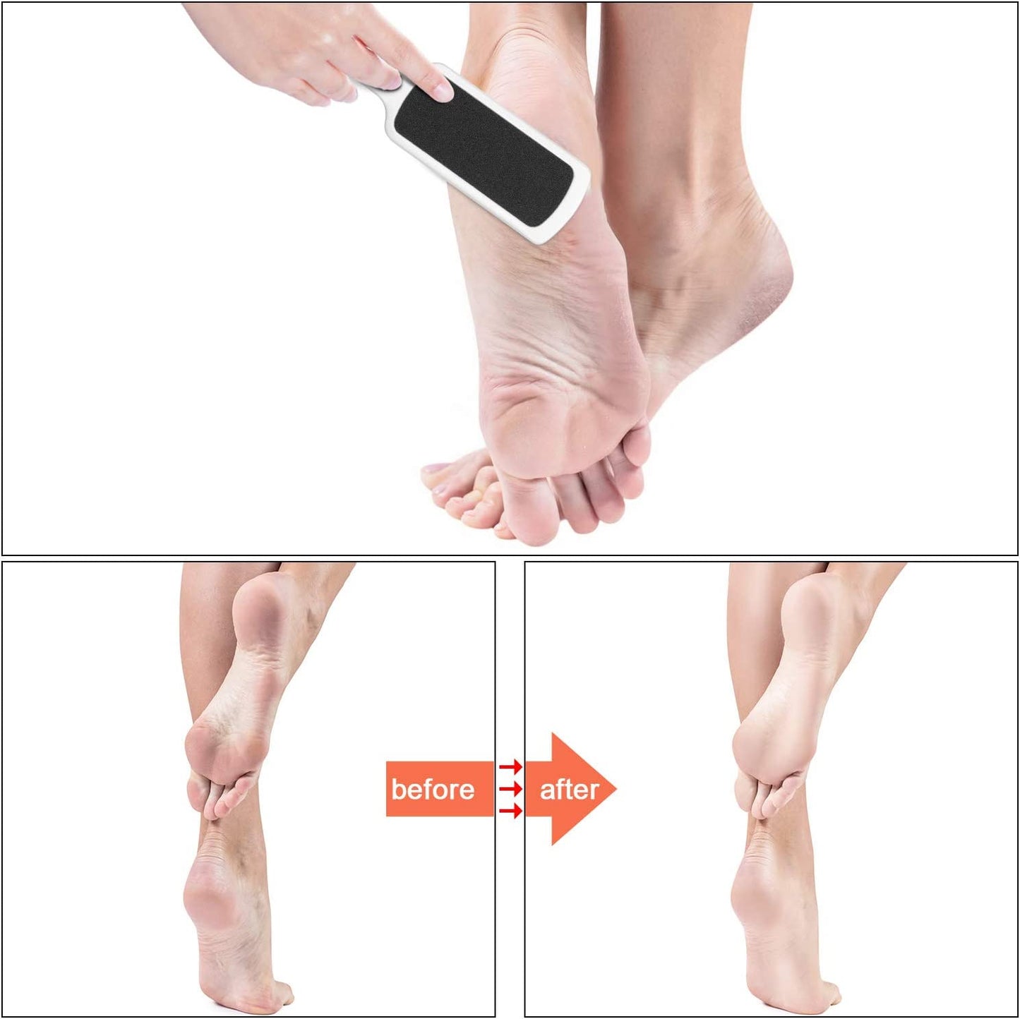 Double-Sided Foot File 3-Pack – Callus Remover for Wet & Dry Use