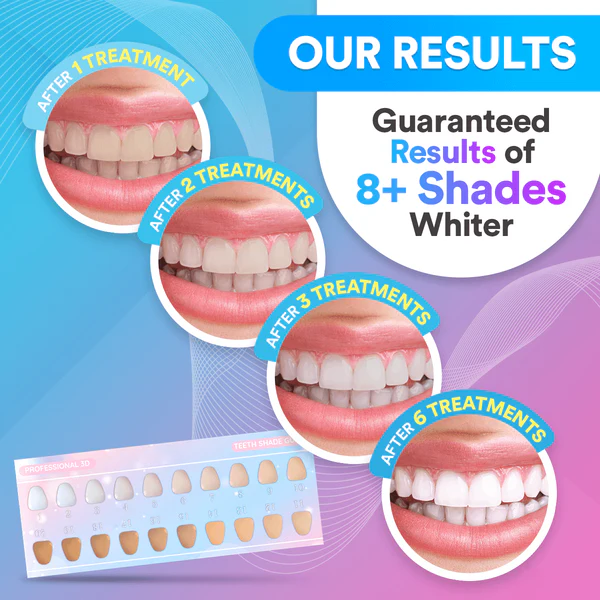 Teeth Whitening Kit – LED Light, 9 Gel Pens, Remineralization Gel & Trays