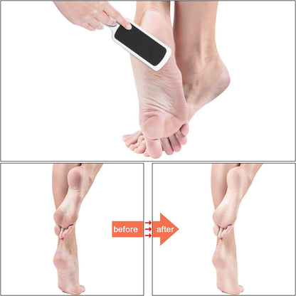 Double-Sided Foot File 3-Pack – Callus Remover for Wet & Dry Use