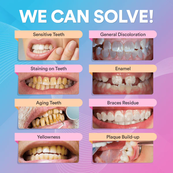 Teeth Whitening Kit – LED Light, 9 Gel Pens, Remineralization Gel & Trays